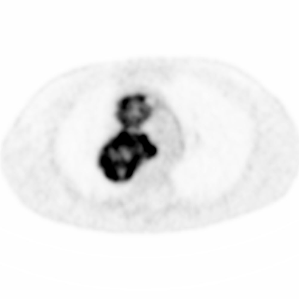 Right Image