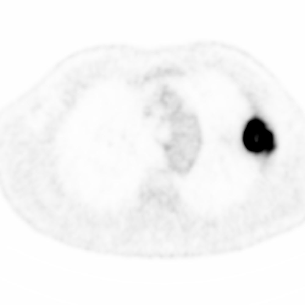 Right Image