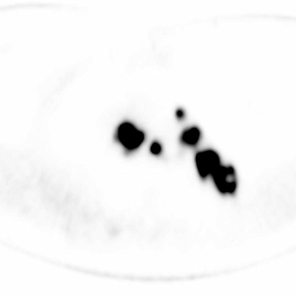 Right Image