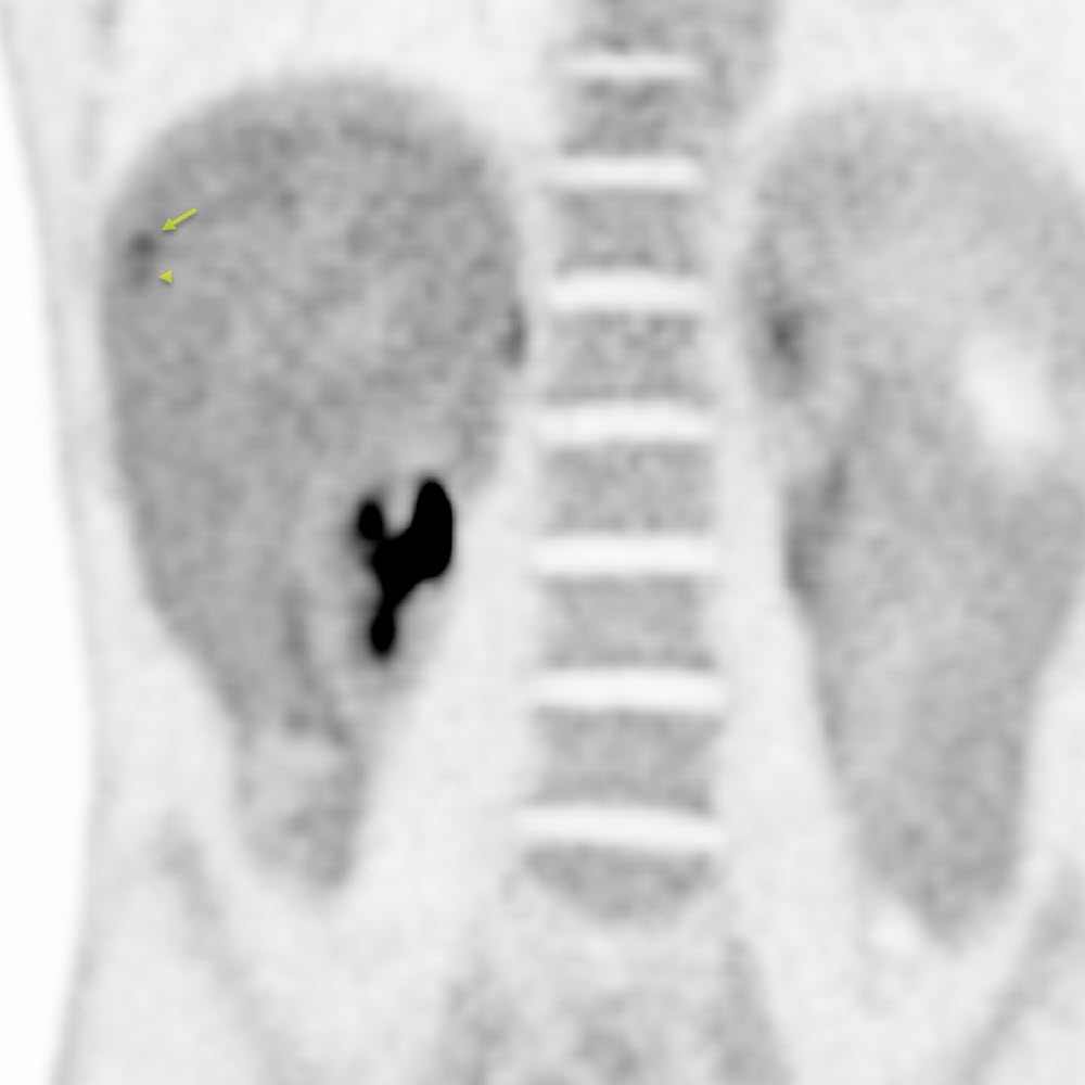 Right Image